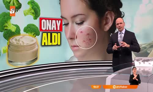 Sivilce için çözüm bulundu! Karnabahar ve brokoli sivilceye çare oldu 