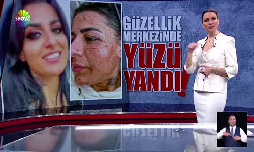 Yüzünde lekeler oluştu