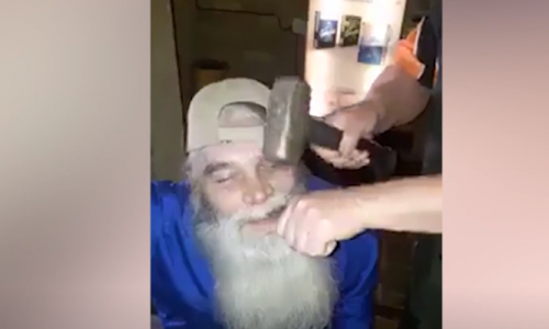 Çekiç ve Penseyle Diş Çekmek