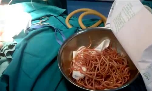 100 adet canlı solungacı mideden çıkması