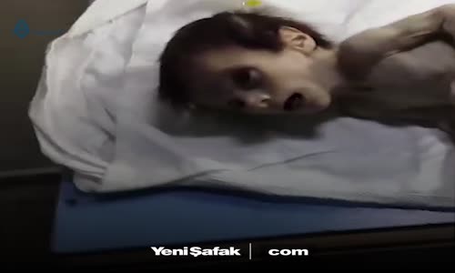 Doğu Guta’daki Açlığın En Somut Görüntüsü!