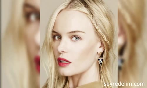 Fiziksel Kusurları Olan 5 Ünlü 