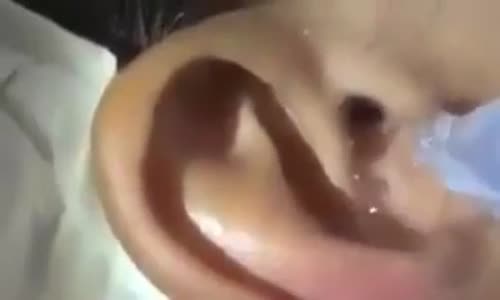 Kulağından Örümcek Çıkan Kadın