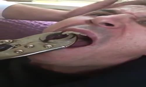 Pense ile Diş Çeken Ambulans Şoförü