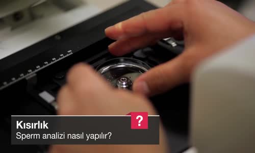 Sperm Analizi Nasıl Yapılır