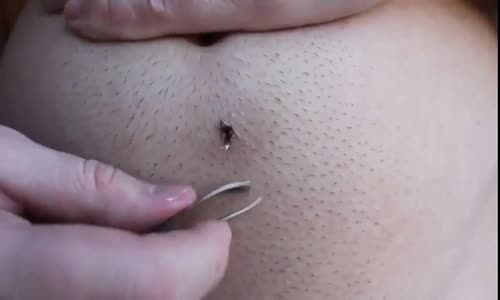 GÖBEĞİNDEKİ KIL DÖNMESİNİ ÇIKARTAN ADAM SOSYAL MEDYAYI SALLADI!