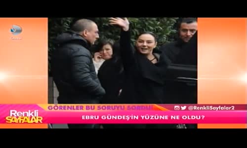 Ebru Gündeş'in Yüzüne Ne Oldu!!