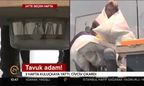 Civciv Çıkartmak İçin Kuluçkaya Yatan Adam