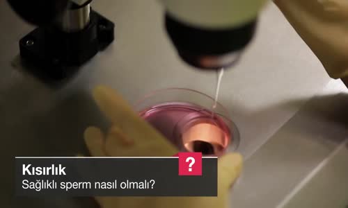 Sağlıklı Sperm Nasıl Olmalı