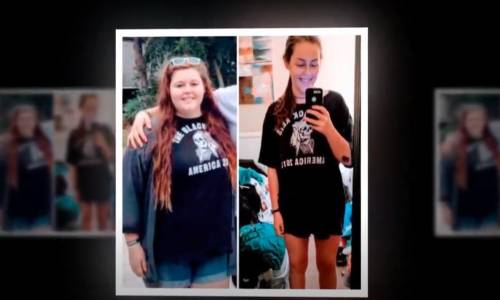 Değişim Dediğin Böyle Olur İşte Öncesi Ve Sonrası Halleri