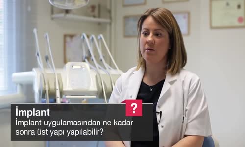 İmplant Uygulamasından Ne Kadar Sonra Üst Yapı Yapılabilir