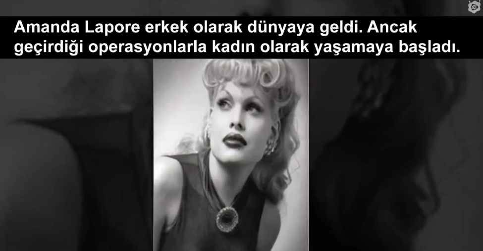 Dünyanın En Kötü 5 Estetik Ameliyatı