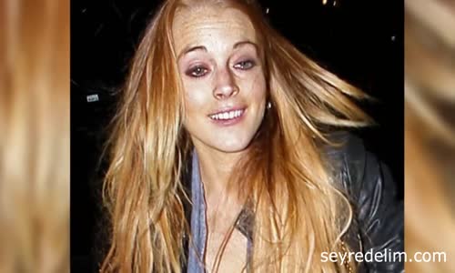 Artık Görseniz Tanıyamayacağınız 5 Ünlü