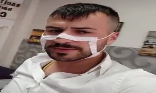 Yazlık Maske İcat Eden Berber 