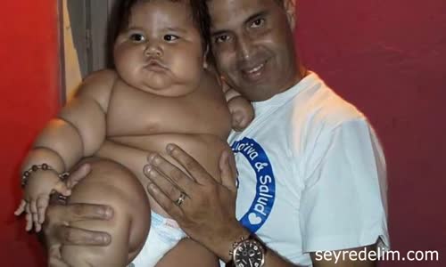 Dünyanın En İlginç Doğan 5 Bebeği