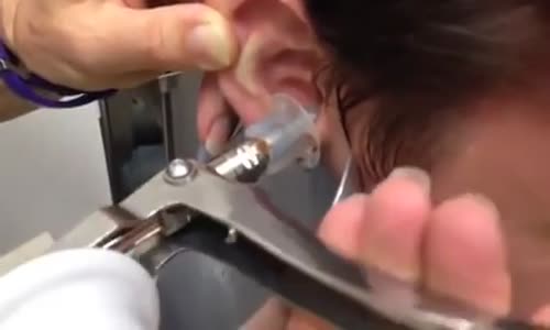 Bunu İzledikten Sonra Bir Daha Kulak Çubuğu Kullanmayacaksınız!