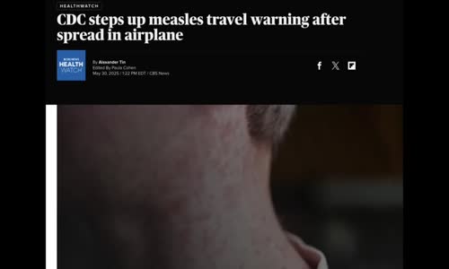 WARNING! DONT TRAVEL UNLESS YOU ARE VAXXXED & EVEN IF YOU ARE PLEASE SEE A DOCTOR AFTER TO BE SAFE!