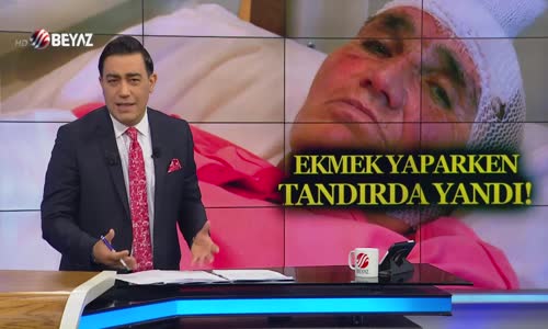 Ekmek yaparken tandırda yandı!