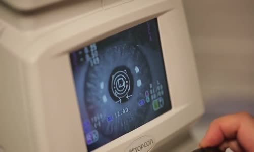 Konjonktivitin Belirtileri Nelerdir