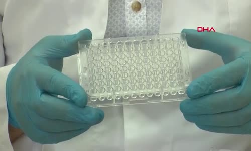 ELİSA testi ile hem koronavirüs hem de antikorun düzeyi tespit ediliyor