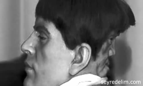 Tarihteki En Tuhaf 5 Sirk Çalışanı 