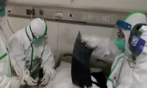 Virüsün gün gün belirtileri 