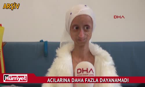 Gamze'den Kötü Haber! Acılarına Daha Fazla Dayanamadı