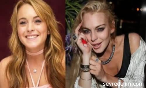 Uyuşturucu Yüzünden Tanınmaz Hale Gelen 4 Ünlü 