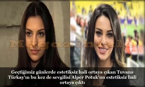 Tuvana Türkay Ve Alper Potuk'un Estetiksiz Halleri!