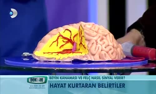 Beyin Kanaması Nasıl Olur