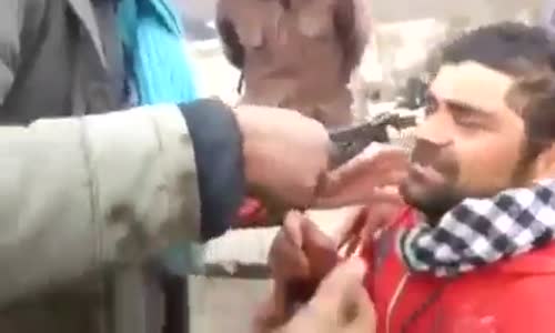 Pense İle Diş Çeken Yurdum İnsanı