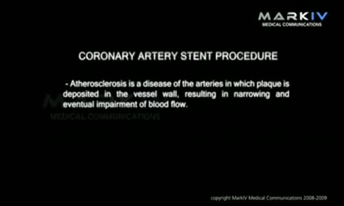 Damar Tıkanıklığının Balon İle Açılması 