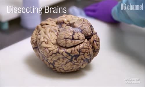 İnsan Beyni İncelemesi +18 (HD)
