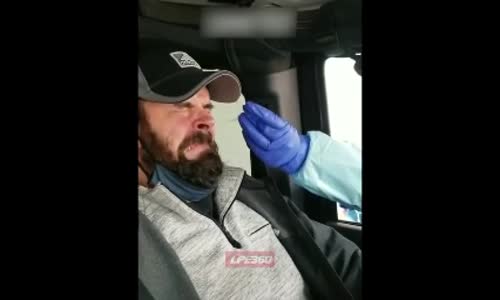 Corona Virüs Testinde Ortaya Çıkan Koca Dil 