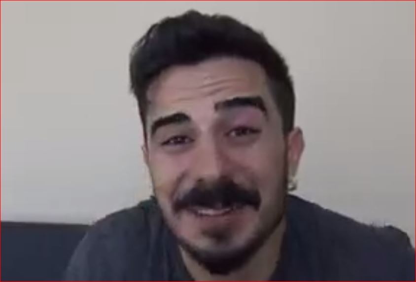 Stres Çarkını 12 Farklı Şekilde Döndürme