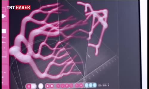 Karaciğer Naklinde 3 Boyut Devrimi