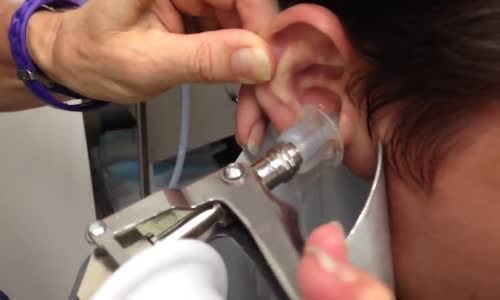 Bunu İzledikten Sonra Bir Daha Kulak Çubuğu Kullanmayacaksınız! 