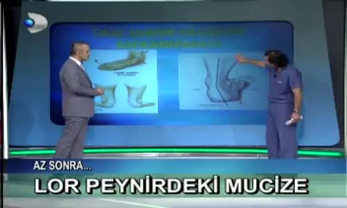 Düz Tabanlık Nasıl Anlaşılır