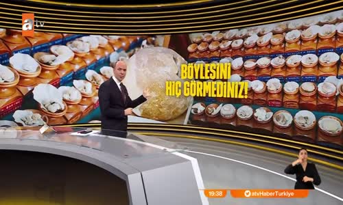 Böbrek taşı sergisi! 