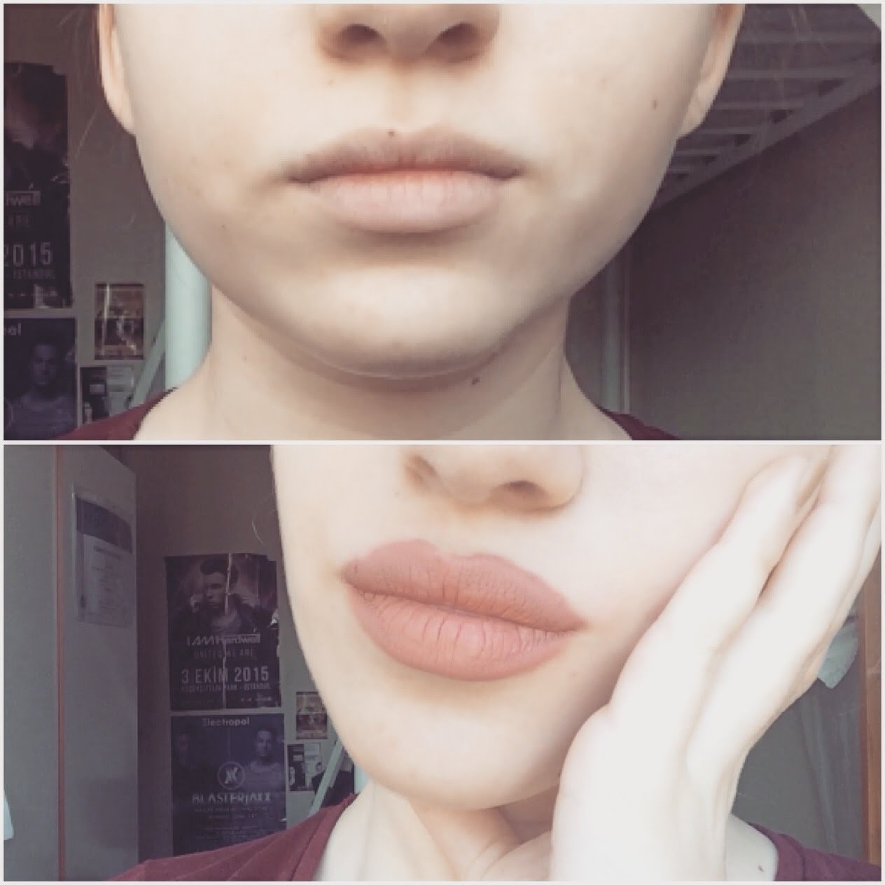 Doğal Ve Pratik Dudak Dolgunlaştırma