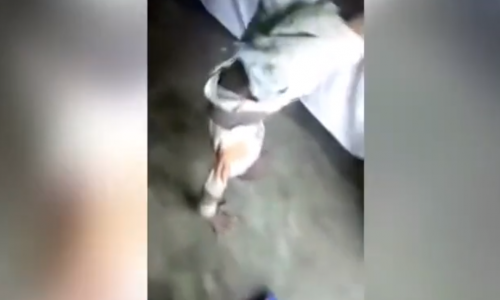 Dansa Kendini Kaptıran Çocuğun Hazin Sonu