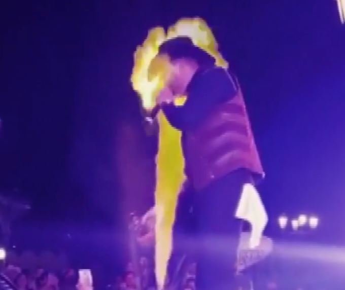 Çalışan Alev Makinesi Sahnedeki Şarkıcının Yüzü Yaktı