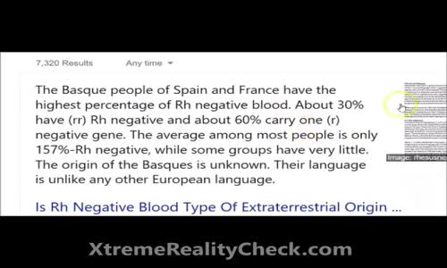 The Rhesus Factor DECEPTION (PT2) RH Negative Blood Type, Nano Infections, Schizophrenia, Viral A.I.