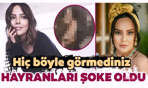 Ebru Gündeş'in Bu Hali Şoke Etti