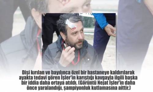 Nejat İşler Saldırıya Uğradı Dişi Kırıldı Bayılıp Kaldı Daha Sonra