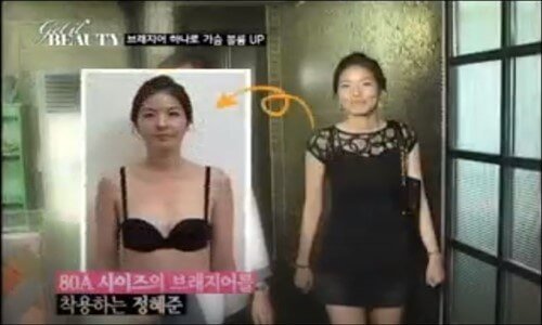 Kore Güzelleşme Programı 