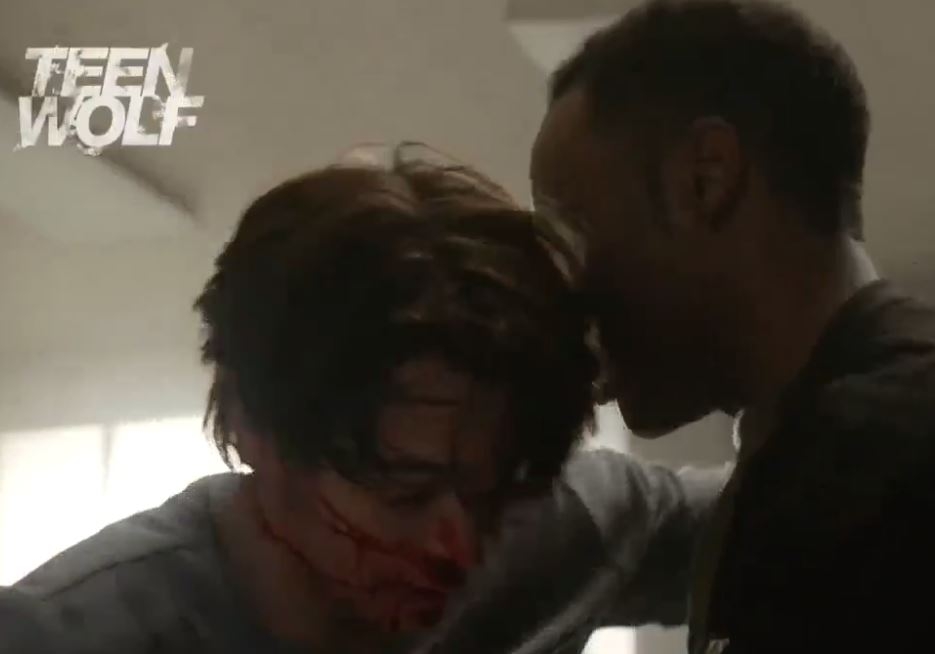 Teen Wolf 6. Sezon 12. Bölüm Fragmanı 