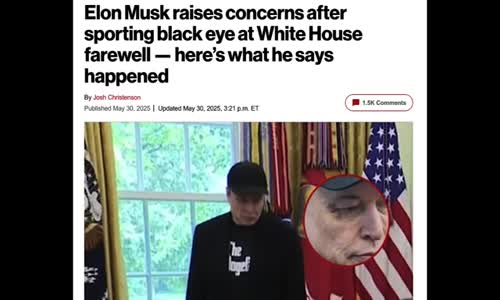 ELON MUSK JOINS THE BLACK EYE CLUB!