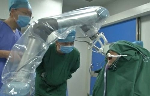 Çinin Robot Diş Doktoru, İlk Ameliyatını Başarıyla Tamamladı