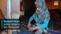 Suriyeli Maya Protez Tedavisi İçin Türkiye'de